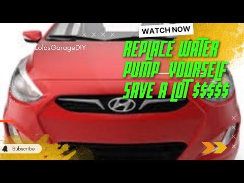 How to Replace the Water Pump on a 2016 Kia Rio (1.6L)