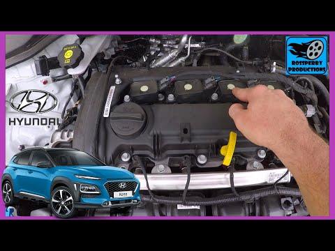 How to Replace Hyundai Kona Ignition Coil Packs &amp; Spark Plugs Tutorial (Kauai &amp; Encino)
